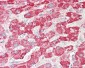 SCHAD / HADHSC Antibody (Internal)